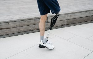 Will Using a Prosthetic Keep Me from Receiving Disability Benefits?